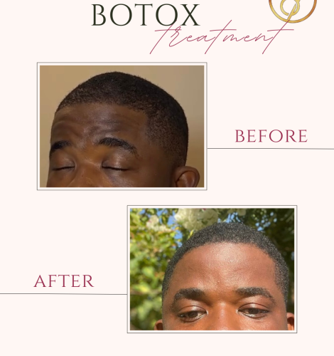 Beige and Pink Elegant Brows Treatment Before After Instagram Post (1)